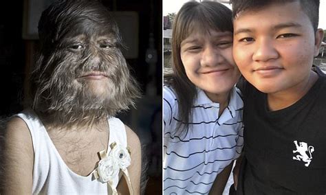 Worlds Hairiest Girl In Thailand Shaves Her Face Daily Mail Online