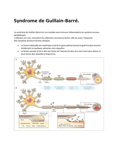 Syndrome de Guillain Barré