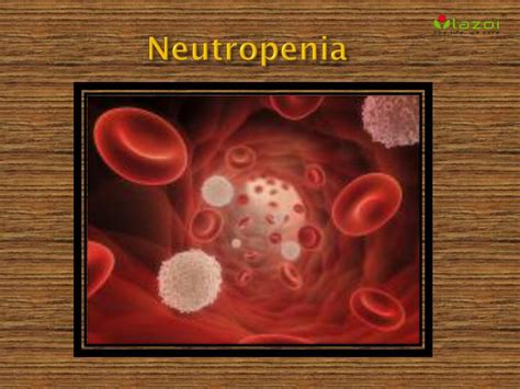 Ppt Neutropenia Causes Symptoms Daignosis Prevention And