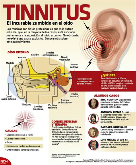 Tinnitus El Incurable Zumbido En El Oído Cdmx Político Medicine