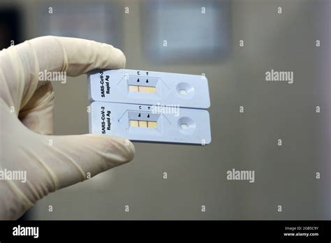 Positive And Negative Results Of Sars Cov 2 Rapid Antigen Ag Test Done