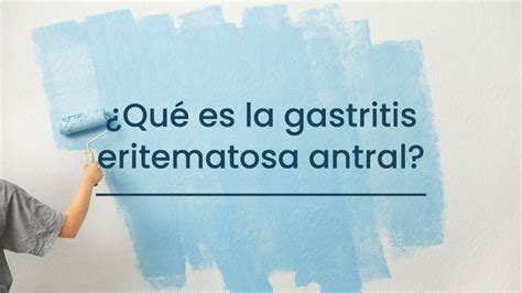 ¿qué Es La Gastritis Eritematosa Antral Youtube
