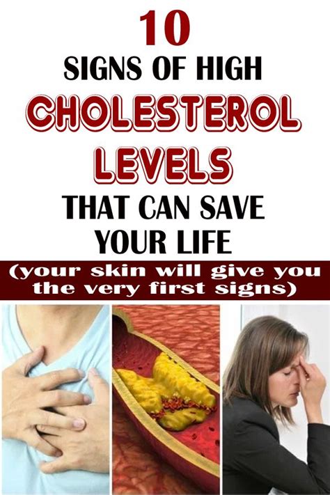 10 Symptoms Of High Cholesterol That You Shouldnt Ignore Cholesterol