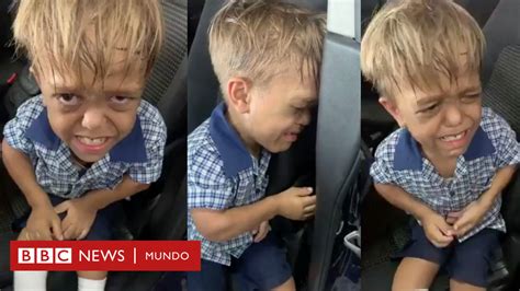 Quaden Bayles El Estremecedor Video De Un Niño De 9 Años Que Dice