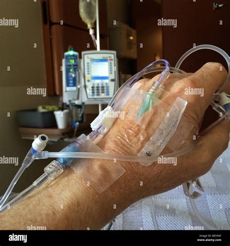 Patient Hand With Iv Drip Stock Photo Alamy