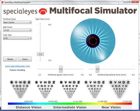 Toric Multifocal Contact Lens Design Case Study