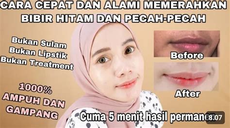 Bikin Bibir Kamu Merah Merona Ini 4 Cara Mencerahkan Bibir Hitam Yang