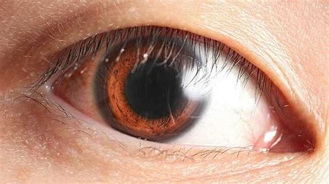 Human Eye Wikiwand