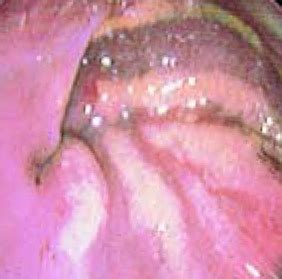 Evaluation can be frustrating for owners and veterinarians because of the long differential list. Dog Gastritis: Treatment Tips and Free Brochures