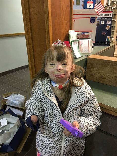 Safyre Terry New York Burn Victim Who Wished For Christmas Cards Gets Free Trip To Disney