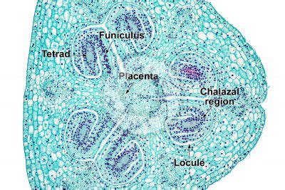 Lily Ovary Cross Section Labeled