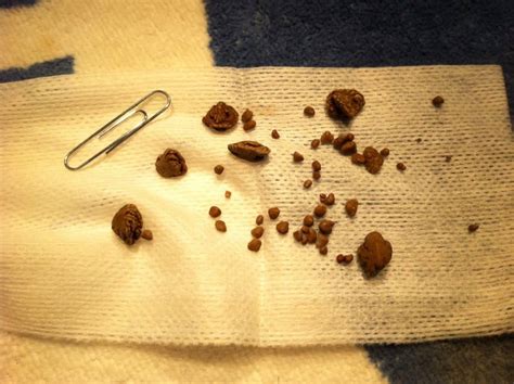 Kidney Stones In Cats What Do You Need To Know About It Cat Lovers