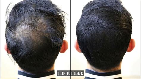 Cover Up Hair Loss Bald Spots Thinning Hair By Thick Fiber Hair