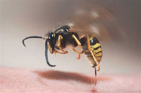 Types Of Stinging Bees And Treatment Of Bee Stings Best Bee Brothers