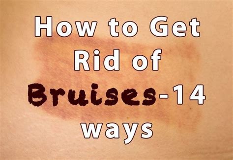 How To Get Rid Of Bruises 14 Ways Healthy Focus Heal Bruises