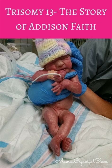Trisomy 13 The Story Of Addison Faith Terminations Remembered