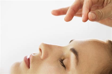 Facial Cosmetic Acupuncture Guildford Surrey The Acupuncture Clinic