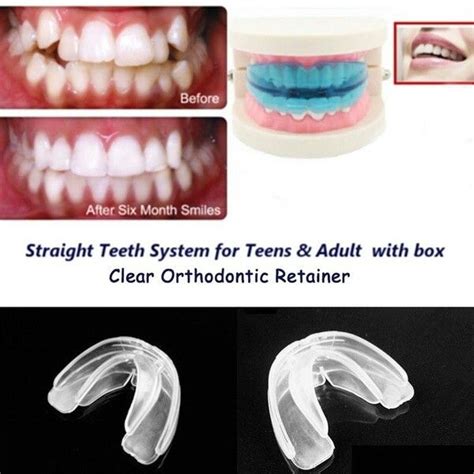 Foods with lots of resistance to chewing, like veggies and jerky, provide plenty of demand for our teeth to get the work necessary to help straighten out misaligned lower. Pin on wish.com wishlist