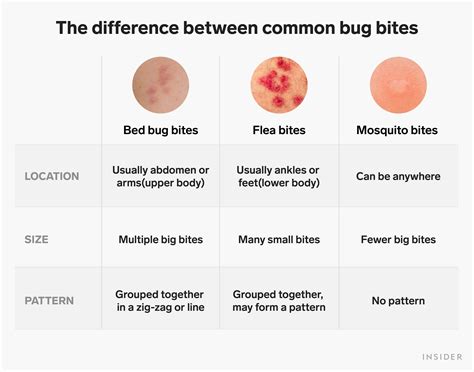 How To Describe Bug Bite Medically