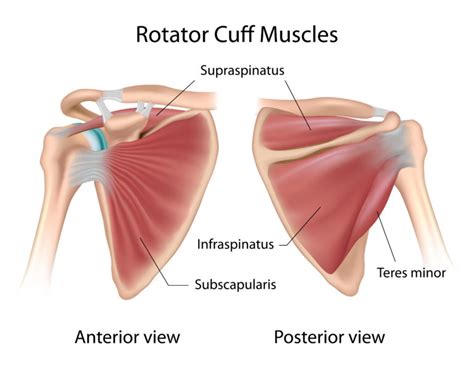 Treatment Options For Rotator Cuff Tears The Orthopaedic Institute