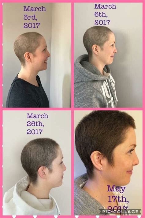 Hair Growth After Chemo Growing Hair After