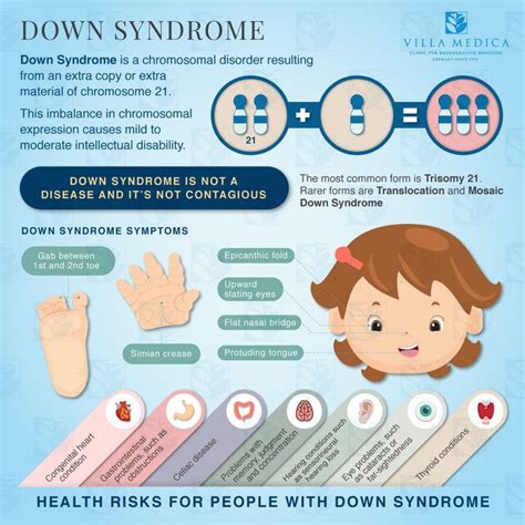 Facts About Down Syndrome Infographic Down Syndrome Kids Down