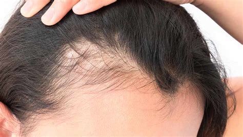 13 best otc products to help regrow thinning hair, according to experts. 5 Cheap Organic Products You Should Use For Thinning Hair ...
