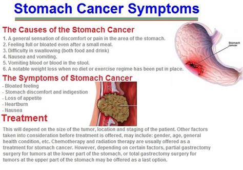 Learn what signs & symptoms of stomach cancer to watch out for such as a poor appetite, weight loss, belly pain, or heartburn. Pin on Stomach Cancer