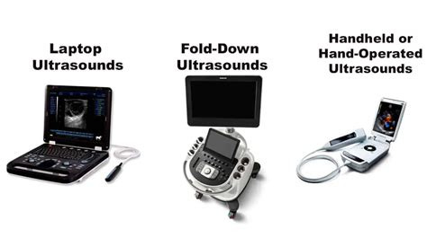 Types Of Ultrasound Machines Hot Sex Picture