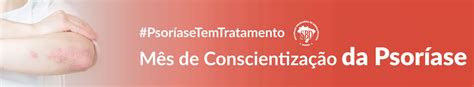 Sociedade Brasileira De Dermatologia Faz Campanha De Conscientização