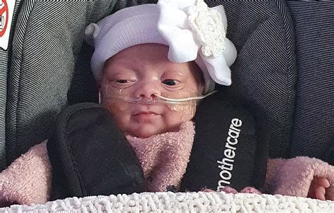 22 Week Old Premature Baby Weighing Just One Pound Goes Home Healthy
