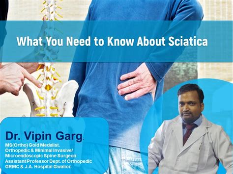 Best Sciatica Blog What You Need To Know About Sciatica 2022 Klm Group