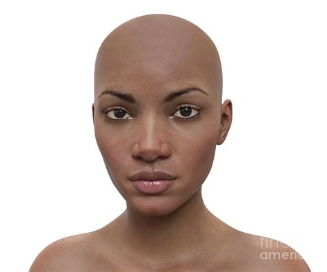 Woman Without Hair Photograph By Kateryna Konscience Photo Library