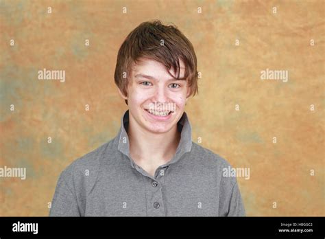 Teenage Boy Acne Hi Res Stock Photography And Images Alamy