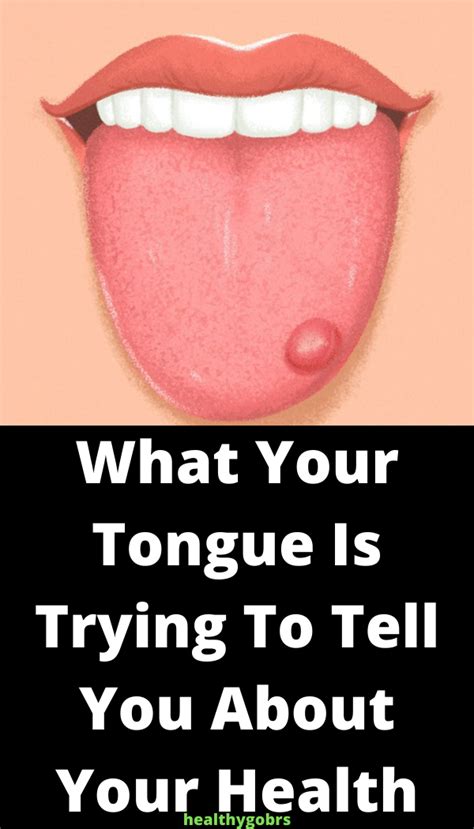 What Your Tongue Is Trying To Tell You About Your Health Healhty And Tips