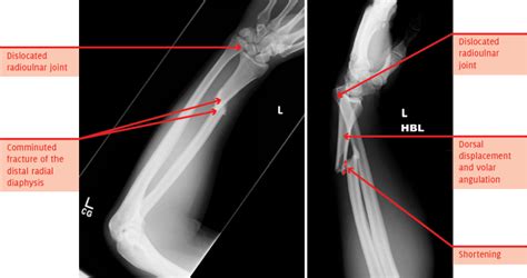 The Unofficial Guide To Radiology 100 Practice Orthopaedic X Rays