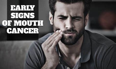 Early Signs Of Mouth Cancer Baccoff