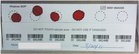 Dried Blood Spot Collection Of Health Biomarkers To Maximize