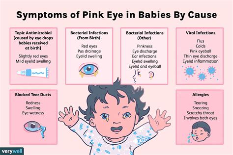 Pink Eye In Babies Causes Symptoms Treatment