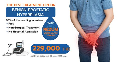 The Best Treatment Option Benign Prostatic Hyperplasia With Rezum Water Vapor Therapy
