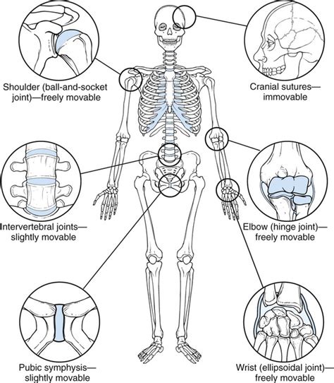 Diseases And Conditions Of The Musculoskeletal System Basicmedical Key