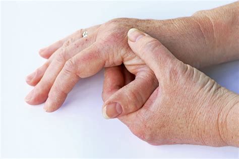 Comprehensive Assessment Of Hand Deformities In Ra Useful Tool For