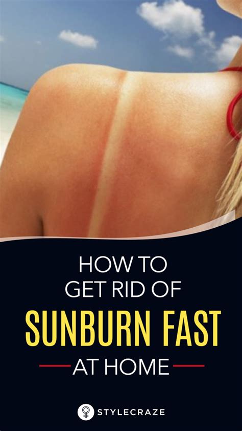 Sunscreen Tips And Tricks Sunburn Remedies Get Rid Of Sunburn Home Remedies For Sunburn