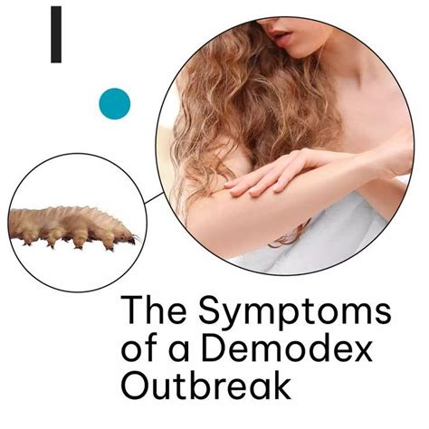 What Are Demodex Mites And Why Do They Live In My Skin And Hair