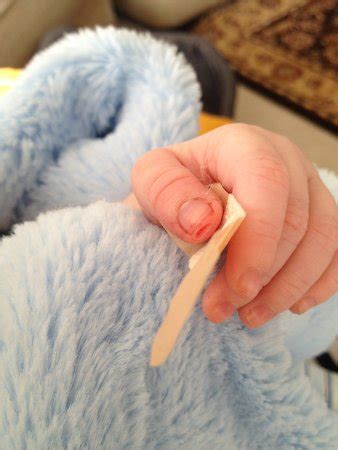 Cut my baby's finger while trimming the nails ...