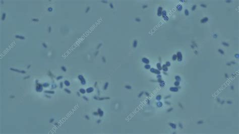 Cold E Coli Bacteria Microscopy Stock Video Clip K0069667
