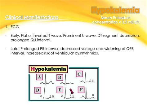 Hypokalemia And Hyperkalemia Ppt 2