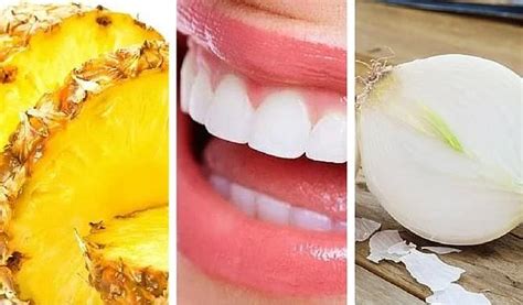 Alimentos Para Dientes Blancos Y Saludables Dentaline