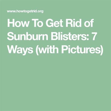 How To Get Rid Of Sunburn Blisters 7 Ways With Pictures Sunburn