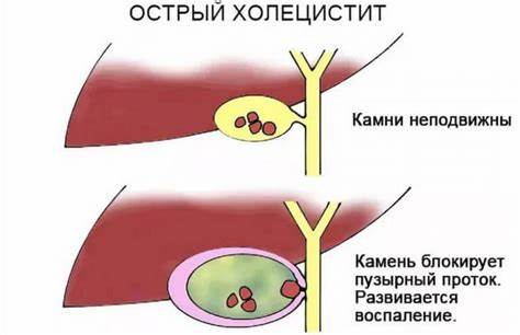 Холецистит симптомы лечение диета хронический Холецистит у собак: симптомы и лечение воспаления желчного пузыря Холецистит у собак: симптомы и лечение воспаления желчного пузыря Холецистит симптомы лечение диета хронический
